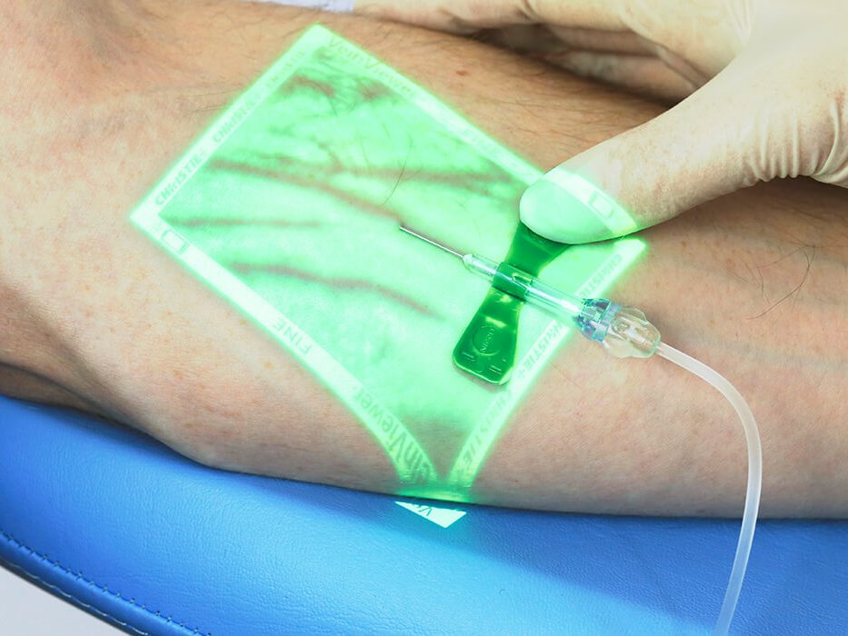 VeinViewer Frequently Asked Clinical Questions